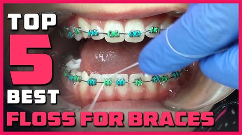 Best Floss for Braces in 2023 - Top 5 Review | Orthodontic Ortho Dental Floss Picks - Dental Clinic