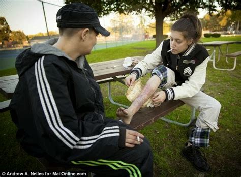 2 Siblings Become The Victim Of Krokodil Drug