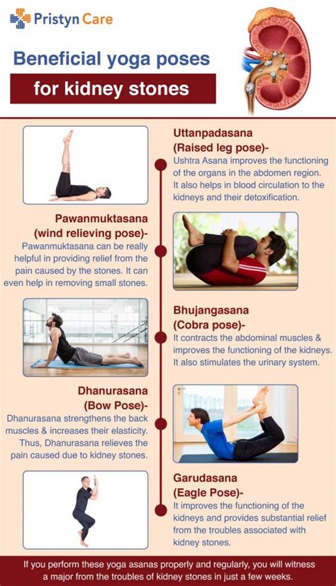 exercise for kidney stone - Caption Simple