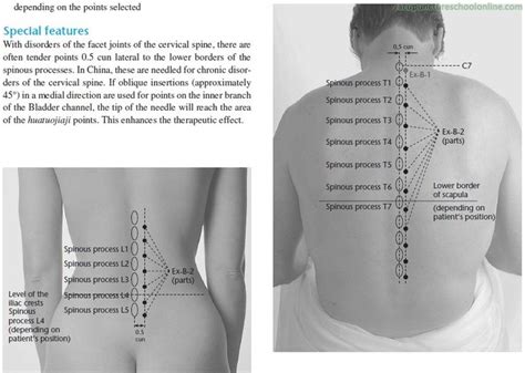 Pin on Acupuncture