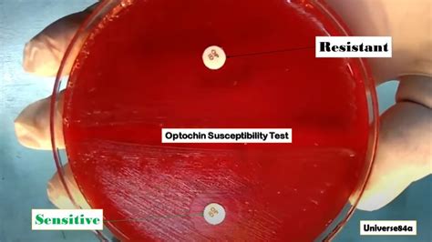 Optochin Sensitivity Test: Introduction, Principle ,Test Requirements, Test