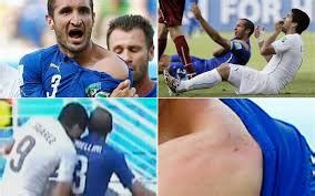 Brazil 2014: Suarez finally apologises for biting incident