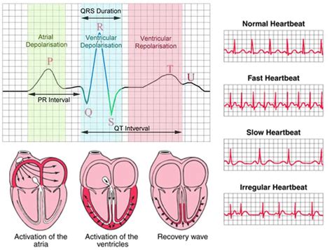 Interpreting heart function data | The A Level Biologist - Your Hub