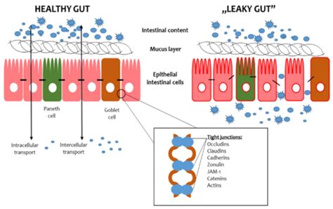 Structure of the gut barrier structure during intestinal permeability.... | Download Scientific ...