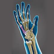 Hand Fracture Surgery Seattle, WA | Hand Injury Treatment Kent, West ...