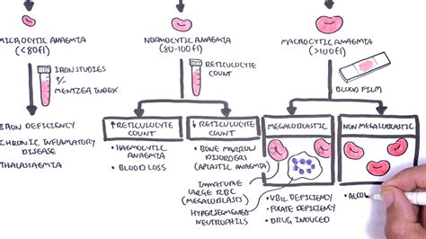 Anaemia (anemia) - classification (microcytic, normocytic and ...