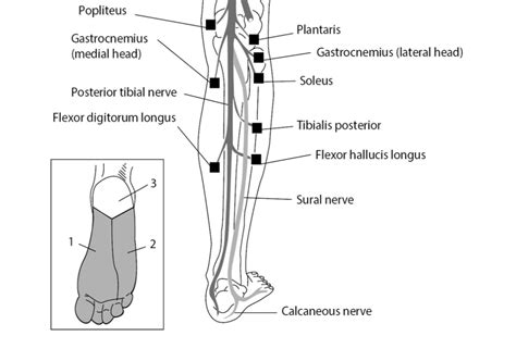 Posterior Tibial Nerve Entrapment