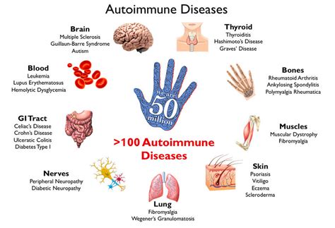 Auto-Immune Disease - What Causes It? - Remede Wellness Medicine