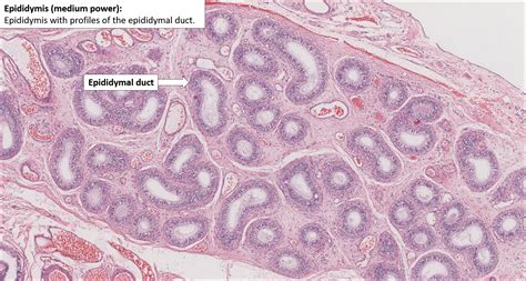 Testis and Epididymis – Normal Histology – NUS Pathweb :: NUS Pathweb