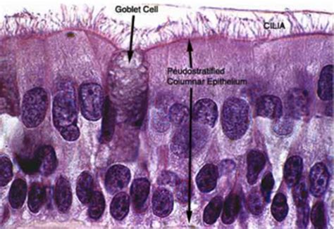 CR1 respiratory histology Flashcards | Quizlet