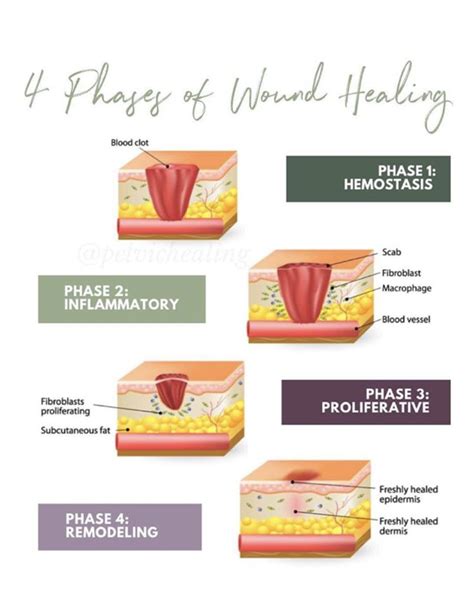 Phases Of Wound Healing