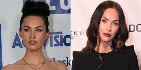 Megan Fox Before and After Plastic Surgery & Net Worth