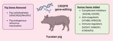 In a First, Genetically Edited Pig Kidney Is Transplanted Into Human ...