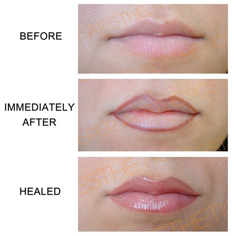 Semi-permanent lip liner. www.deeperaesthetics.co.uk | Permanent lipstick, Lip permanent makeup