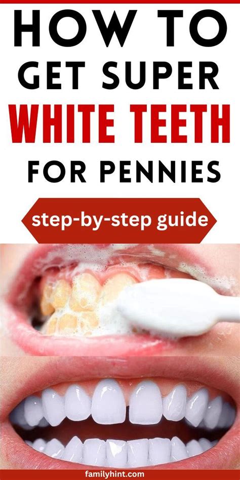 How to Whiten Teeth Naturally | If you want to know how to whiten your ...