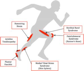 Common Running Injuries – Marathoners