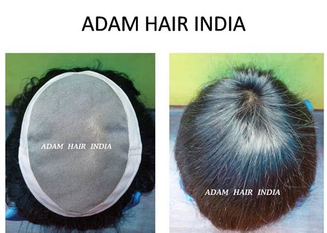 Alopecia Wigs For Men, Gents Wig, पुरुषों के नकली बाल in Anna Nagar, Chennai , Adam Hair India ...