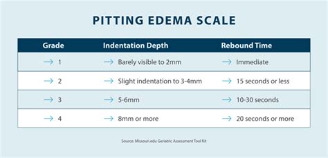 What Is Pitting Edema? Tactile Medical, 50% OFF