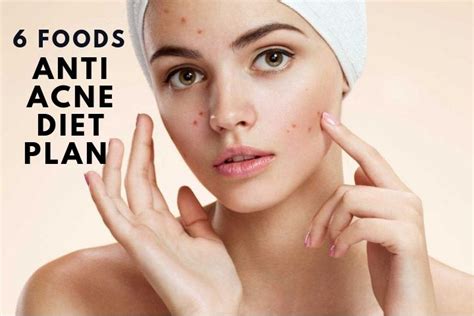 6 Anti Acne Diet Plan For Free Skin Girlicious Beauty