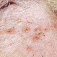 What Causes Impetigo In Dogs