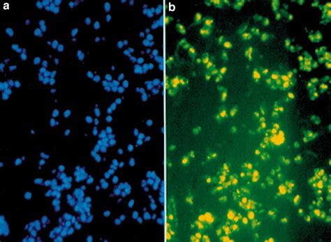 Fluorescence for DAPI and 6-FAM-labelled ODN in MCL scar. (a)... | Download Scientific Diagram