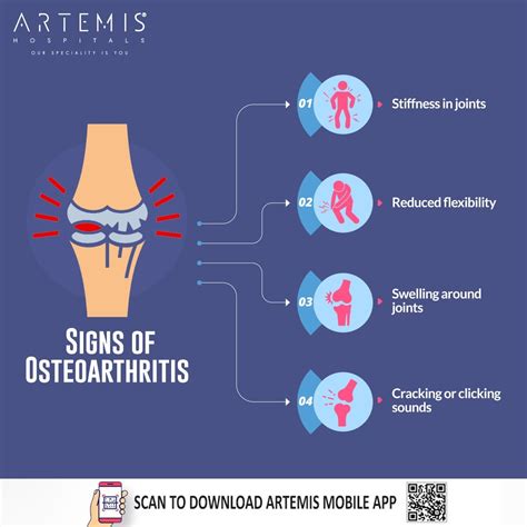 Joint pain is the most common symptom... - Artemis Hospitals