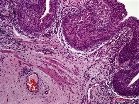 The appearance of muscularis mucosae in a bladder specimen. H&E stain ...