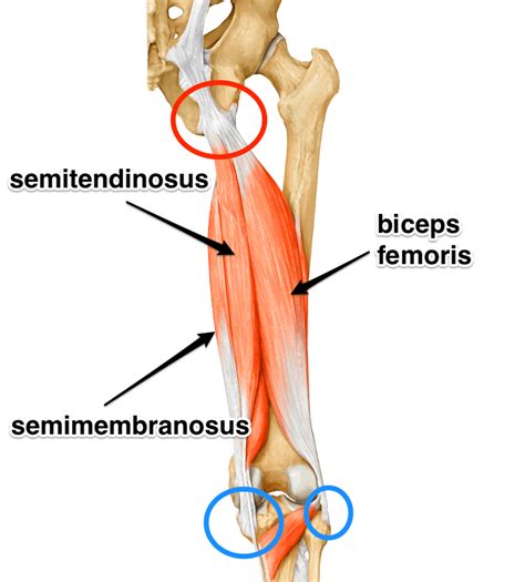 Biceps Femoris Tendon Pain