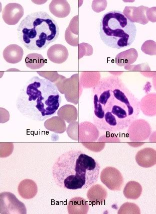 Normal neutrophils | eClinpath