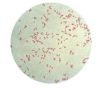 Pseudomonas Aeruginosa Gram Stain