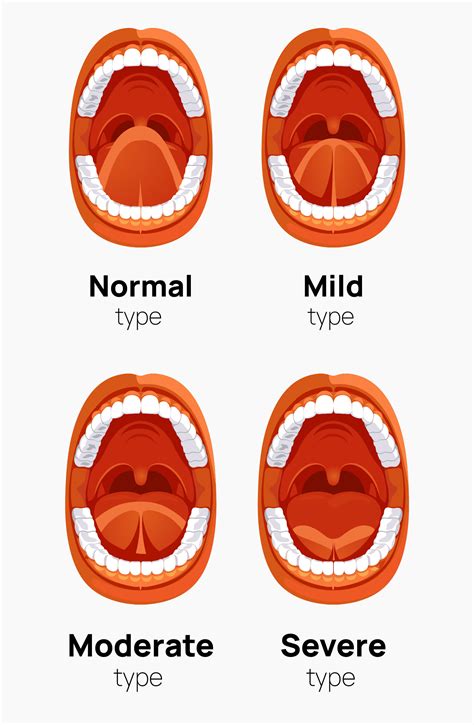 Tongue-Tie in Adults: Treatment Options| Healthnews