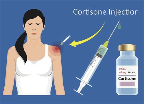 Are Cortisone Injections Bad for You? Debunking the Myths - Sport ...