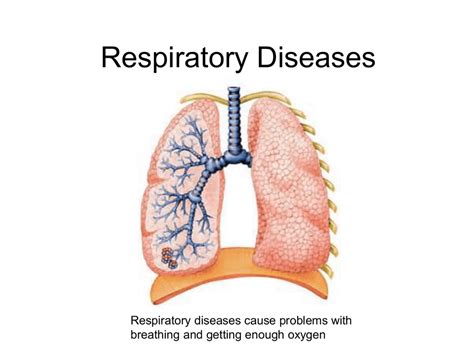 Three main types of lung disease - PowerPoint