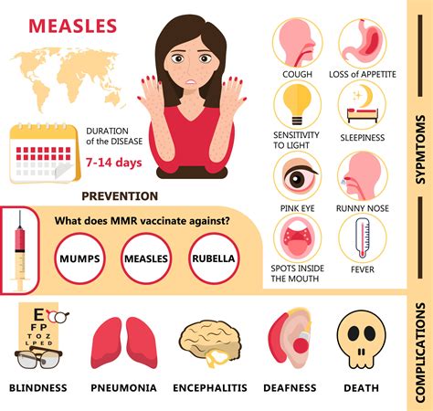 Measles infographic concept vector. Infected boy with papules on the ...