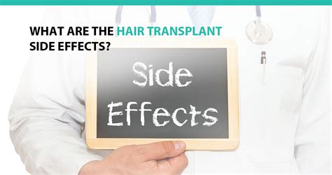 What Are the Hair Transplant Side Effects? - Advanced Medical Hair ...