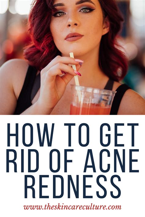 How to Treat Redness From Acne, According to a Dermatologist | Acne ...