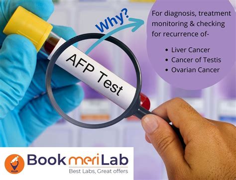 AFP Tumor Marker Test: Price, Purpose, Results & Range [2024]