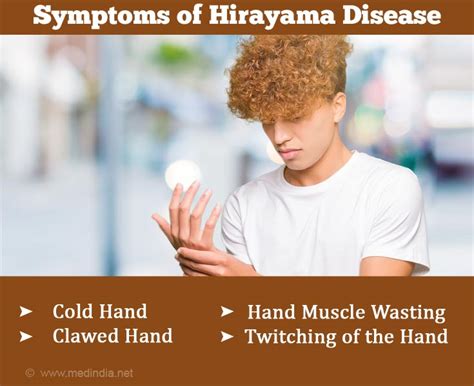 Causes and Symptoms of Hirayama Disease