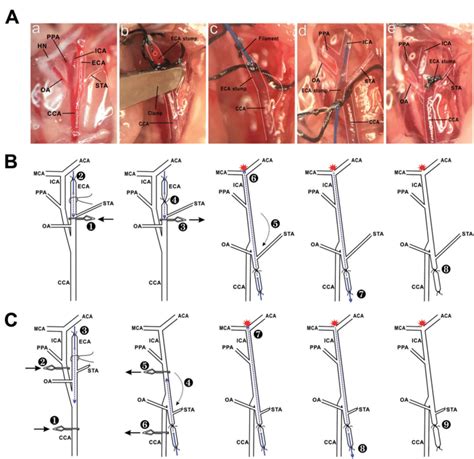 Steps of the "single clip" and "double clips" surgical procedures. (A ...