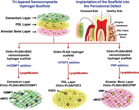 Concise Review: Periodontal Tissue Regeneration Using Stem Cells ...