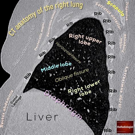 👨🏽‍💻A sagittal view of the right lung and the position of the oblique ...