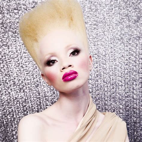 Refilwe Modiselle ♥ Albinism | Albino model, Natural hair styles, Beauty