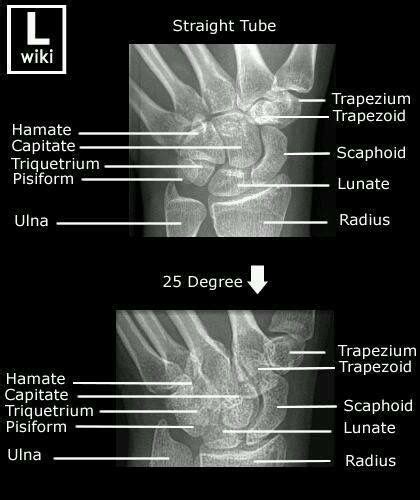 Pin de Stephanie Otz en - Radiography Anatomy - | Anatomía médica ...