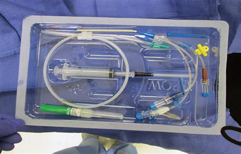 Central Venous Catheter Placement: Modified Seldinger Technique ...