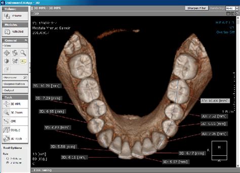 Figure 1 from Accuracy and reliability of orthodontic dental ...