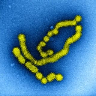 Swine Flu Strain Virus Particles | Colorized transmission el… | Flickr