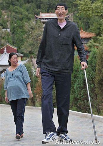 Pin by Larry Smith Media on Acromegaly & Gigantism | Tall people, Giant ...