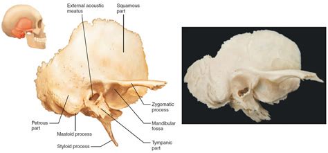 Temporal bone anatomy, parts of temporal bone & temporal bone fracture