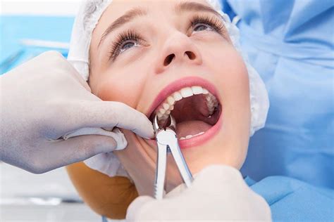 Tooth Extractions in West New York | Dentist in West New York, NJ 07093