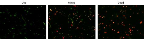 Cell Meter™ Bacterial Viability Assay Kit | AAT Bioquest